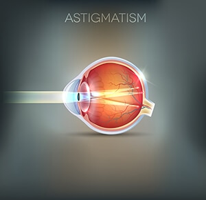 Astigmatism Diagram